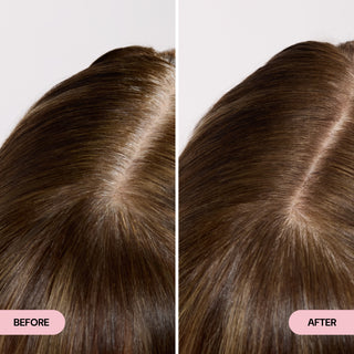 before and after