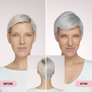 Before and After 